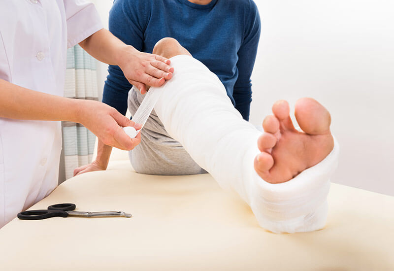 Bandaging leg
