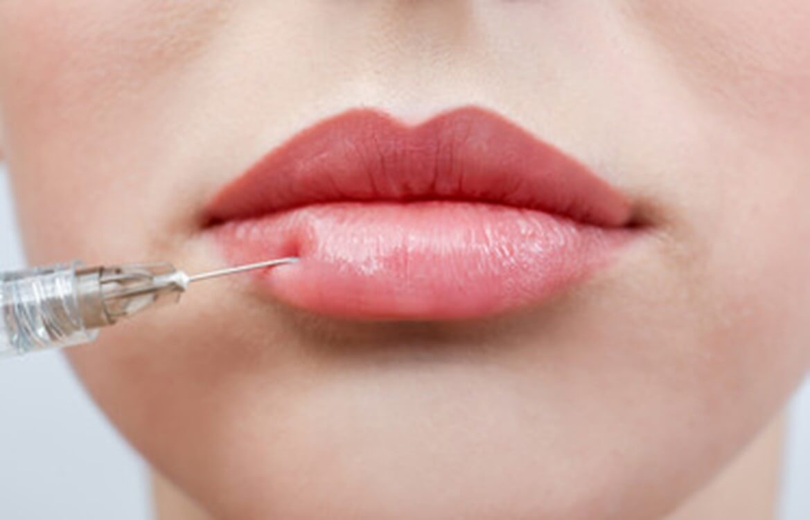 Derma Filler